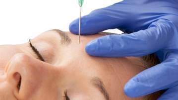 Botox spritzen – Hilfe bei lästigen Fältchen